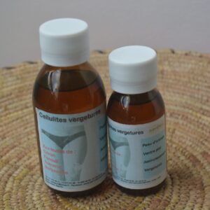 Cellulite vergetures