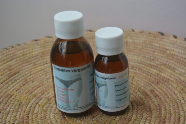Cellulite vergetures